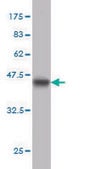 Monoclonal Anti-BFSP1 antibody produced in mouse clone 6B4, purified immunoglobulin, buffered aqueous solution