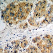 Anti-phospho-53BP1 (pSer6) antibody produced in rabbit affinity isolated antibody