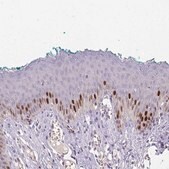 Anti-HELLS antibody produced in rabbit Prestige Antibodies&#174; Powered by Atlas Antibodies, affinity isolated antibody, buffered aqueous glycerol solution