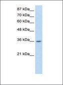 Anti-RP11-78J21.1 (AB1) antibody produced in rabbit affinity isolated antibody