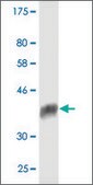 Monoclonal Anti-PPIL1 antibody produced in mouse clone 1B5, purified immunoglobulin, buffered aqueous solution