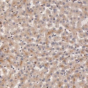 Anti-BCHE antibody produced in rabbit Prestige Antibodies&#174; Powered by Atlas Antibodies, affinity isolated antibody, buffered aqueous glycerol solution