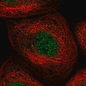 Anti-KLHDC3 antibody produced in rabbit Prestige Antibodies&#174; Powered by Atlas Antibodies, affinity isolated antibody, buffered aqueous glycerol solution, ab2