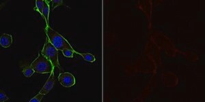 Anti-Cortactin (p80/85) Antibody, clone 4F11, Alexa Fluor&#8482; 647 Conjugate clone 4F11, from mouse, ALEXA FLUOR&#8482; 647