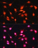 Anti-METTL3 antibody produced in rabbit