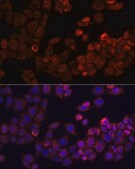 Anti-FAK antibody produced in rabbit