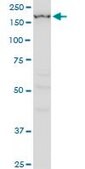 Monoclonal Anti-IGSF1 antibody produced in mouse clone 4C7, purified immunoglobulin, buffered aqueous solution