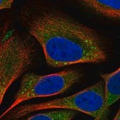 Anti-TMEM184B antibody produced in rabbit Prestige Antibodies&#174; Powered by Atlas Antibodies, affinity isolated antibody, buffered aqueous glycerol solution