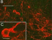 Anti-CAR Antibody, clone RmcB clone RmcB, Upstate®, from mouse
