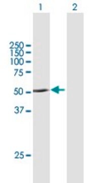 Anti-PNPLA1 antibody produced in mouse purified immunoglobulin, buffered aqueous solution