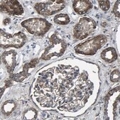 Anti-KIAA1958 antibody produced in rabbit Prestige Antibodies&#174; Powered by Atlas Antibodies, affinity isolated antibody, buffered aqueous glycerol solution