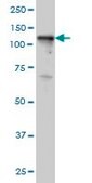 ANTI-TYK2 antibody produced in mouse clone 5A4, purified immunoglobulin, buffered aqueous solution
