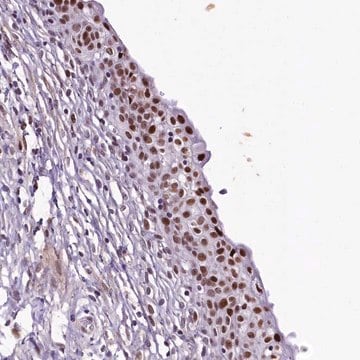 Anti-SAMD10 antibody produced in rabbit Prestige Antibodies&#174; Powered by Atlas Antibodies, affinity isolated antibody, buffered aqueous glycerol solution