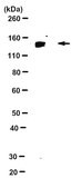 Anti-TRPM4