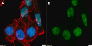 Anti-SUMO-2/3 Antibody, clone 1D9 ZooMAb® Rabbit Monoclonal recombinant, expressed in HEK 293 cells