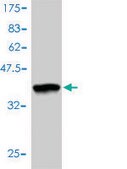 Monoclonal Anti-RAD51C antibody produced in mouse clone 3F3-5C6, purified immunoglobulin, buffered aqueous solution