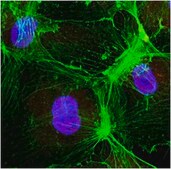 Anti-Caspase 3 Antibody from rabbit, purified by affinity chromatography