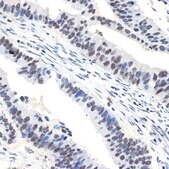 Anti-NAT10 antibody produced in rabbit