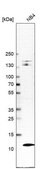 Anti-LSM2 antibody produced in rabbit Prestige Antibodies&#174; Powered by Atlas Antibodies, affinity isolated antibody, buffered aqueous glycerol solution