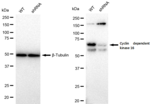 KD-Validated Anti Cyclin dependent kinase 16 Antibody, clone 23GB1495, Rabbit Monoclonal clone 23GB1495, recombinant rabbit monoclonal, expressed in HEK293 cells