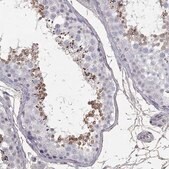 Anti-SUN3 antibody produced in rabbit Prestige Antibodies&#174; Powered by Atlas Antibodies, affinity isolated antibody, buffered aqueous glycerol solution
