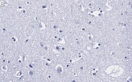 Anti-Prion Protein Antibody, clone 3D17 ZooMAb® Rabbit Monoclonal recombinant, expressed in HEK 293 cells