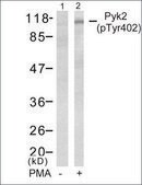 Anti-phospho-PTK2B (pTyr402) antibody produced in rabbit affinity isolated antibody