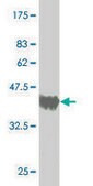 Monoclonal Anti-THRAP5, (N-terminal) antibody produced in mouse clone 2B7, purified immunoglobulin, buffered aqueous solution