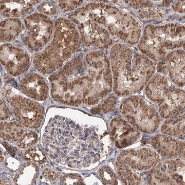 Anti-RWDD4 antibody produced in rabbit Prestige Antibodies&#174; Powered by Atlas Antibodies, affinity isolated antibody, buffered aqueous glycerol solution