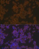 Anti-PLC gamma 2 (PLCG2) Antibody, clone 7I1C9, Rabbit Monoclonal
