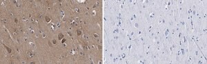 Anti-Catenin-α 2 Antibody, clone 3F7 ZooMAb® Rabbit Monoclonal recombinant, expressed in HEK 293 cells
