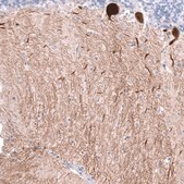 Monoclonal Anti-CALB1 antibody produced in mouse Prestige Antibodies® Powered by Atlas Antibodies, clone CL15059, purified antibody (Protein A)