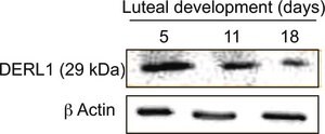Anti-Derlin-1 antibody produced in rabbit ~1 mg/mL, affinity isolated antibody, buffered aqueous solution