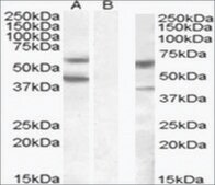Anti-DGAT2 antibody produced in goat affinity isolated antibody, buffered aqueous solution