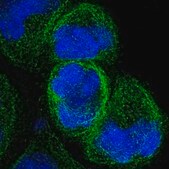 Anti-IFT43 antibody produced in rabbit Prestige Antibodies&#174; Powered by Atlas Antibodies, affinity isolated antibody, buffered aqueous glycerol solution