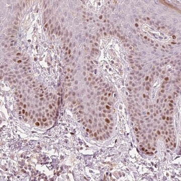 Anti-TREX2 antibody produced in rabbit Prestige Antibodies&#174; Powered by Atlas Antibodies, affinity isolated antibody, buffered aqueous glycerol solution