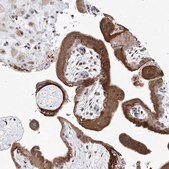 Anti-LACE1 antibody produced in rabbit Prestige Antibodies&#174; Powered by Atlas Antibodies, affinity isolated antibody, buffered aqueous glycerol solution, ab3