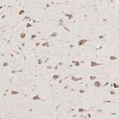 Anti-RNF213 antibody produced in rabbit Prestige Antibodies&#174; Powered by Atlas Antibodies, affinity isolated antibody, buffered aqueous glycerol solution