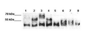 Anti-MAPT antibody produced in rabbit affinity isolated antibody