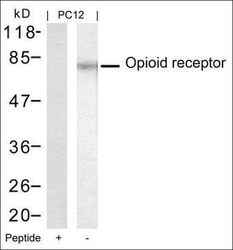 Anti-OPRM1 (Ab-375) antibody produced in rabbit affinity isolated antibody