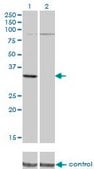 Monoclonal Anti-PRPS2 antibody produced in mouse clone 4C1, purified immunoglobulin, buffered aqueous solution