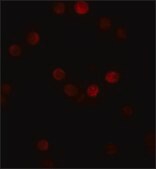 Anti-SIP1 antibody produced in rabbit affinity isolated antibody, buffered aqueous solution
