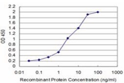 Monoclonal Anti-SMAD5 antibody produced in mouse clone 4F10, purified immunoglobulin, buffered aqueous solution