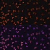 Anti-Acetyl-Histone H2A-K5 antibody produced in rabbit