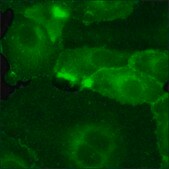 SKOV3 Cells GFP-HER2 RFP-EGFR
