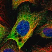 Anti-EFCAB14 antibody produced in rabbit Prestige Antibodies&#174; Powered by Atlas Antibodies, affinity isolated antibody, buffered aqueous glycerol solution
