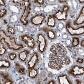 Anti-SLC47A1 antibody produced in rabbit Prestige Antibodies&#174; Powered by Atlas Antibodies, affinity isolated antibody, buffered aqueous glycerol solution