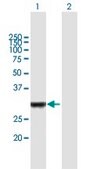 Anti-IRAK1BP1 antibody produced in mouse purified immunoglobulin, buffered aqueous solution