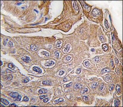 Anti-GPC4 (N-term) antibody produced in rabbit saturated ammonium sulfate (SAS) precipitated, buffered aqueous solution