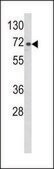 ANTI-ARHGAP18 (CENTER) antibody produced in rabbit IgG fraction of antiserum, buffered aqueous solution